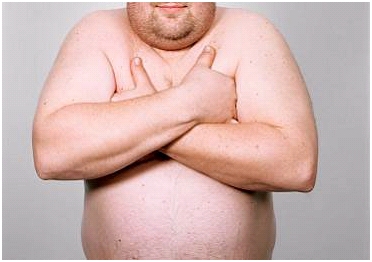 Impotência sexual masculina em obesos Impotência sexual masculina em obesos