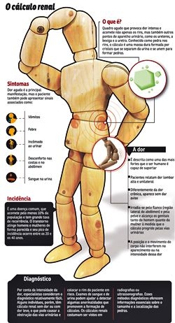 Pedra nos Rins ou Cálculo Renal Pedra nos Rins ou Cálculo Renal